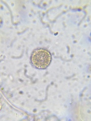 Heliozoa