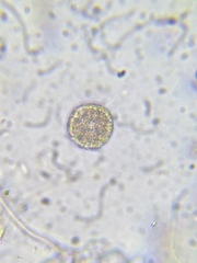 Heliozoa