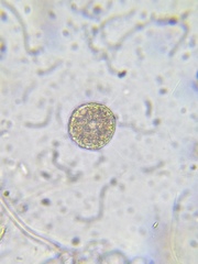 Heliozoa