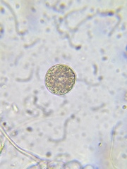 Heliozoa