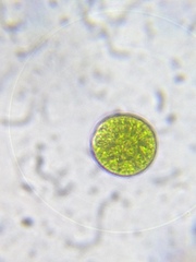 Asterococcus superbus