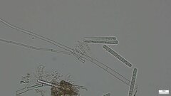 Calonectria