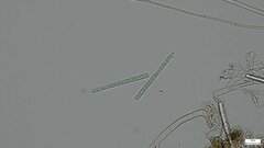 Calonectria