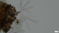 Calonectria