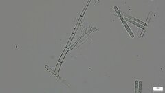 Calonectria