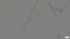 Calonectria