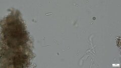 Ascocoryne cylichnium