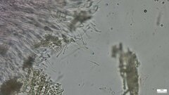 Ascocoryne cylichnium