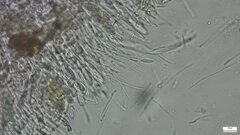 Ascocoryne cylichnium