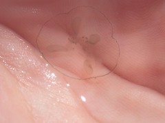 Craspedacusta sowerbii