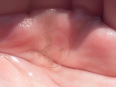 Craspedacusta sowerbii