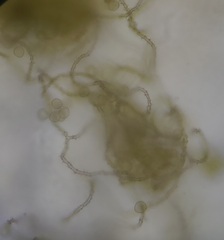 Ophiotheca chrysosperma