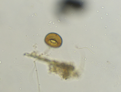 Arcella hemisphaerica