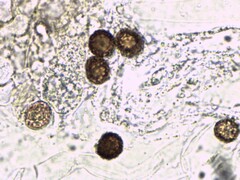 Strobilomyces