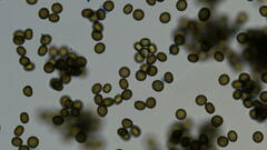 Ustilago syntherismae