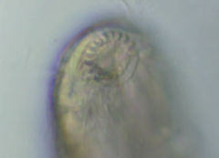 Chaetonotus polyspinosus