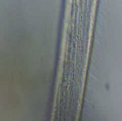 Spirostomum