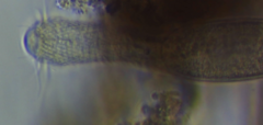 Heterolepidoderma
