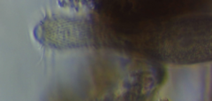 Heterolepidoderma