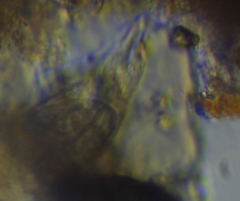 Heterolepidoderma