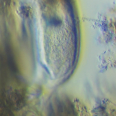 Heterolepidoderma