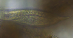 Heterolepidoderma