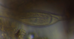 Heterolepidoderma