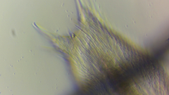 Chaetonotus polyspinosus