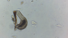 Chaetonotus polyspinosus