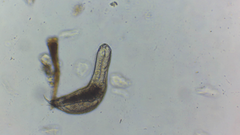 Chaetonotus polyspinosus