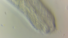 Chaetonotus polyspinosus