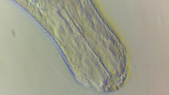 Chaetonotus polyspinosus