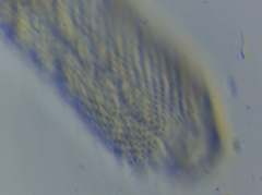 Chaetonotus polyspinosus