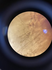 Cladosporium cladosporioides