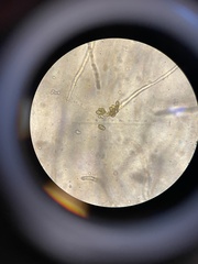 Cladosporium cladosporioides