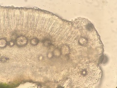 Bacidia phyllopsoropsis