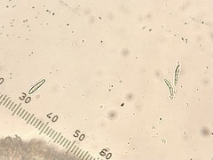 Bacidia phyllopsoropsis