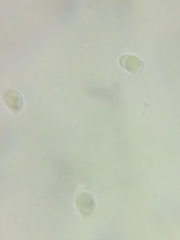 Pseudolaccaria pachyphylla