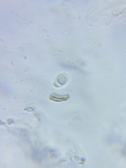 Pseudolaccaria pachyphylla