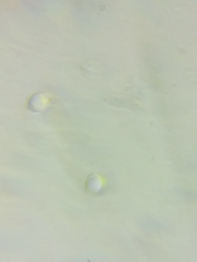 Pseudolaccaria pachyphylla