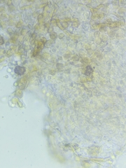 Pseudolaccaria pachyphylla