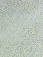 Pseudolaccaria pachyphylla