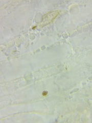 Pseudolaccaria pachyphylla