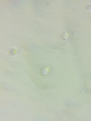 Pseudolaccaria pachyphylla