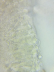 Pseudolaccaria pachyphylla