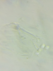 Pseudolaccaria pachyphylla