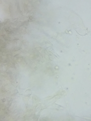 Pseudolaccaria pachyphylla