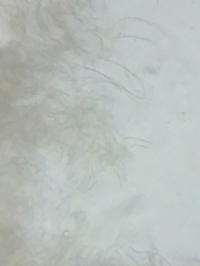 Pseudolaccaria pachyphylla