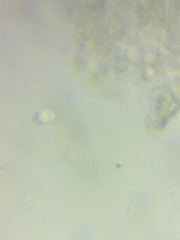 Pseudolaccaria pachyphylla