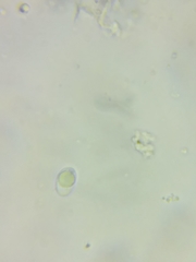 Pseudolaccaria pachyphylla